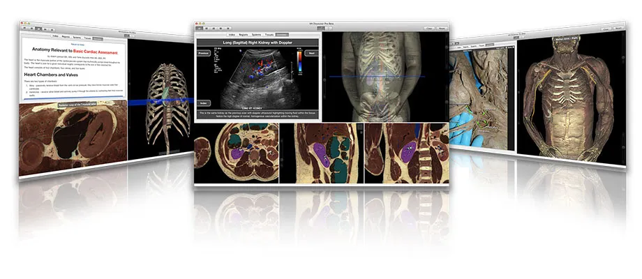 vh-dissectorpro